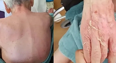 Huzurevinde ölüme verilen taksitli para cezasının gerekçesi: Gerekli tedbirler alınmamış