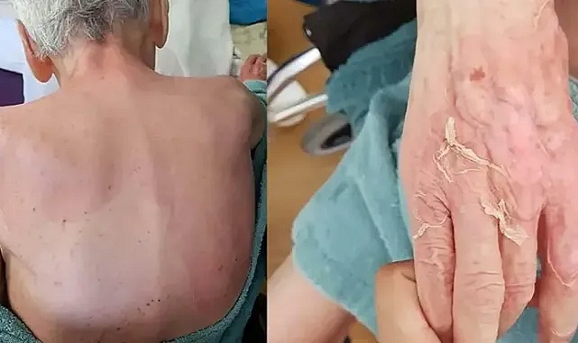 Huzurevinde ölüme verilen taksitli para cezasının gerekçesi: Gerekli tedbirler alınmamış